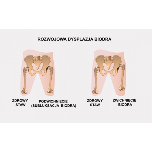 Obustronna orteza stawu biodrowego z regulacją zakresu ruchomości stawów oraz regulacją długości szyn udowych AM-SB/1RE DUAL