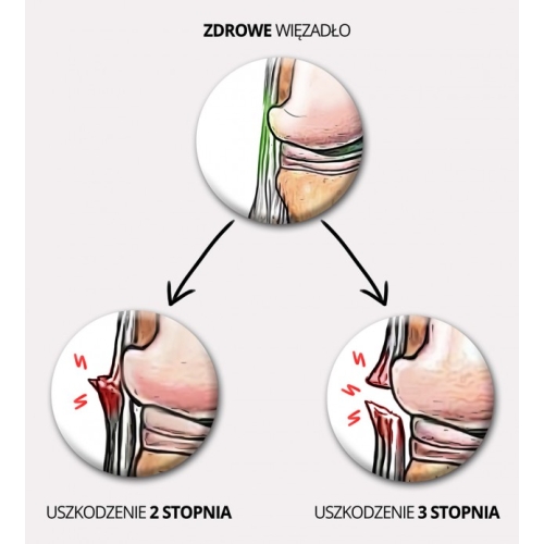 Aktywna orteza wspomagająca więzadła stawu kolanowego OKD-23