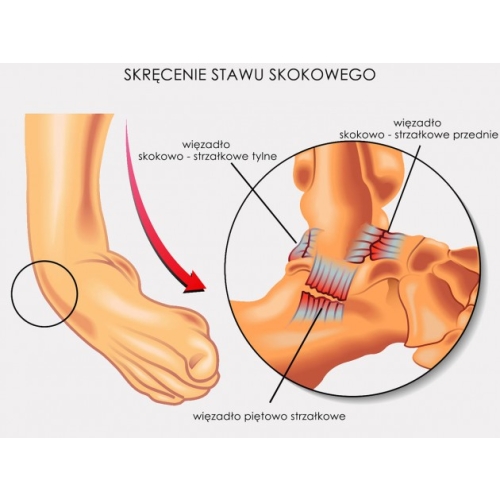 Anatomiczna orteza stawu skokowego z łuskami stabilizującymi i zapięciem krzyżowym AM-SX-08