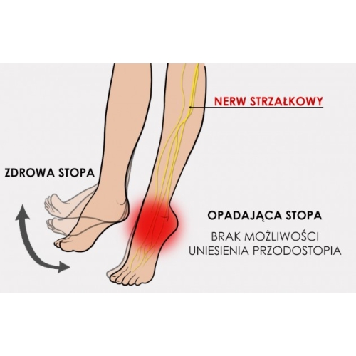 Aktywna orteza podeszwowa na opadającą stopę OSS-OS-02
