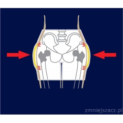 Pas Biordrowy - Safe hip Female AirX 